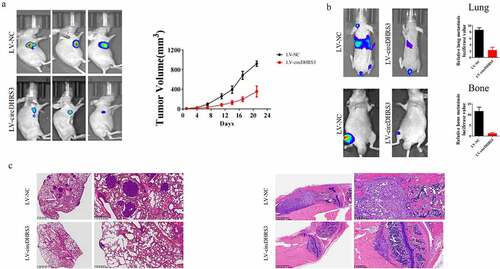 Figure 6. Overexpression of circDHRS3 decreased prostate cancer proliferation and metastases in vivo. (a). Tumour sizes were measured and compared for LV-NC-PC3 and LV-circDHRS3-PC3 xenografts in nude mice after 21 days. Tumour formation was detected using live imaging. (b). The lung or bone metastasis ability of LV-NC-PC3-Luc and LV-circDHRS3-Luc by intravenous tail injection or intratibial injection was detected using live imaging. (c). HE staining of lung and bone after injection of LV-NC-PC3-Luc and LV-circDHRS3-Luc.