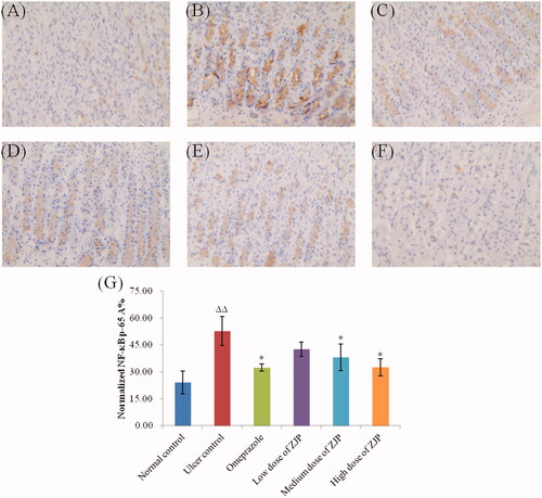 Figure 13. Effect of ZJP on the expression of NF-κB p65 in gastric mucosa by immunohistochemical staining (400 × magnification): (A) normal control group, (B) ulcer control group, (C) omeprazole group, (D) low dose of ZJP group; (E) medium dose of ZJP group; (F) high dose of ZJP group and (G) The normalised NF-κB p65 A%. The antigen site of NF-κB p65 appears as a brown colour (n = 6). Δ: comparing with the normal control group, *: comparing with the ulcer control group.