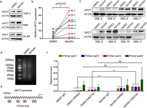 Figure 3. QPCT is identified as a potential downstream target of Apicidin in AML cells. (a) QPCT protein expression was detected by western blot in THP-1, NB4 and HL-60 cells treated with Apicidin or DMSO for 48h. (b-c) Qrt-PCR (b) and western blot (c) analyses of QPCT expression in Apicidin-treated AML MNCs. (d) Ultrasonication effiency of the genomic DNA detected by agarose gel electrophoresis. (e) Sketch map showing the distribution of primers used to expand the putative H3K27ac and H3K9ac binding sites in QPCT promoter region. (f) ChIP-Qrt-PCR analysis of H3K27ac and H3K9ac binding level in the QPCT promoter region after Apicidin treatment in HL-60 cells. *P< .05, **P< .01, ns: not significant, Student’s t-test.
