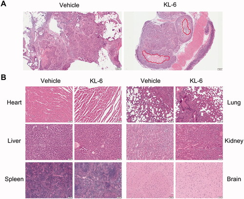 Figure 5. H&E staining of tumour and major organs sections. (A) Tumour stained with H&E, and red circle represents necrosis (Scale bar = 200 μm). (B) Histological section of anatomical heart, liver, spleen, lung, kidney, and brain (Scale bar = 100 μm).