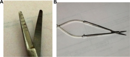 Figure 6 Mansur–Aran Graft Harvesting Pterygium Debunking Scissors (Rhein Medical Inc., St Petersburg, FL, USA): (A) tip and (B) full view.