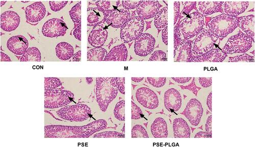 Figure 5 Effect of PSE-NPs on testicular histology in mice. The CON group showed a normal organizational structure. The Model group and PLGA group showed cell shedding and a decrease in the spermatogenic-cell layer. Compared with the Model group, the PSE group and PSE-PLGA group had significantly improved histology, and the PSE-PLGA group had the best effect. Black arrows mark showing spermatogenic cell layers.