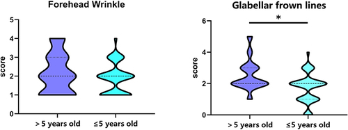 Figure 4 Upper face wrinkle score between older than 5 years old and less than 5 years old groups in women aged 31–40.