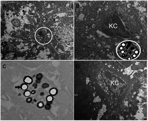 Figure 8 TEM images of treated mice liver (A ×6k, B ×15k and C ×30k) and control group (D ×15k) sacrificed 24 hrs post-injection with ZrO2. Black arrow indicates ZrO2 particles.Abbreviation: KC, Kupffer cells.