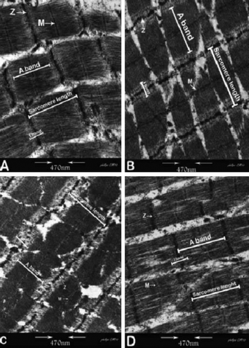 Figure 1. Transmission electron micrographs of beef (M. longissimus dorsi) and ostrich muscle (M. iliofibularis). Notes: (A) beef, 2 h after slaughter; (B) beef, 24 h after slaughter; (C) Ostrich, 2 h after slaughter; and (D) Ostrich, 24 h after slaughter. Figura 1. Micrografía de transmisión de electrones de músculo de buey (M. longissimus dorsi) y de avestruz (M. iliofibularis). Notas: (A): buey, dos horas tras la matanza, (B): buey, 24 horas tras la matanza, (C): avestruz, dos horas tras la matanza, (D): avestruz, 24 horas tras la matanza.