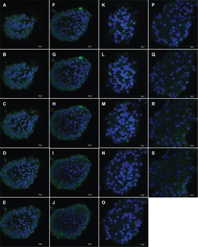 Figure 3 Aromatase differential expression in undifferentiated male and female NSCs. Aromatase expression was visualized on consecutive layers by confocal microscopy on NSCs isolated from the SVZ of three-month-old male (A–J) and female (K–S) rats and grown as neurospheres.