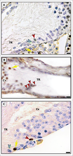 Figure 3. BrdU immunostaining in the transition region (TR) and in the area adjacent to the TR (Cx) in pre-pubertal (A and B) and adult (C) Wistar rats. Proliferating Sertoli cells were found in TR (red arrowheads), and a cluster of BrdU labeled Sertoli cells was found in pre-pubertal rat (B). Negative Sertoli cells are indicated by green arrowhead (A and C). Proliferating germ cells are shown by yellow arrows. Bar: 10 μm.