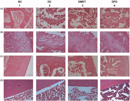 Figure 2. Light photomicrographs of sagittal sections of rat femur from different experimental groups. Normal control rats showing (A1) branching and anatomising thick trabeculae (T) separated by bone marrow (BM) spaces with some fatty tissue, (B1) well-developed growth plate, (C1) normal healthy articular cartilage, and (D1) cortical bone of femur diaphysis with haversian canals [indicated by green arrow] and osteocytes in their lacunae [indicated by black arrow]. Diabetic rats revealed (A2) thinning of the bone trabeculae with widening of the bone marrow spaces, (B2) disruption of the growth plate, (C2) reduction in articular cartilage quality at the femoral condyle, (D2) Multiple eroded [indicated by red arrow] areas at the endosteal surface of the cortical bone were obtained. Diabetic rats treated with metformin showing (A3) sparse and thinning trabeculae, with loss of connectivity and presence of abundant adiposity cells, containing a noticeable increased fatty tissue, (B3) wider distal femur growth plate, (C3) erosion of articular cartilage, and (D3) increase cortical porosity. Diabetic rats treated with F. deltoidea displaying (A4) larger areas covered with trabeculae and increased bone matrix density, (B4) epiphyseal plate arranged in layered array, (C4) thicker calcified cartilage component, and (D4) less cortical erosion. (A) Distal metaphysis trabecular (magnification 200×); (B) Distal epiphylseal plate (magnification 400×); (C) articular cartilage (magnification 200×) and (D) Cortical bone of femur diaphysis (magnification 200×).