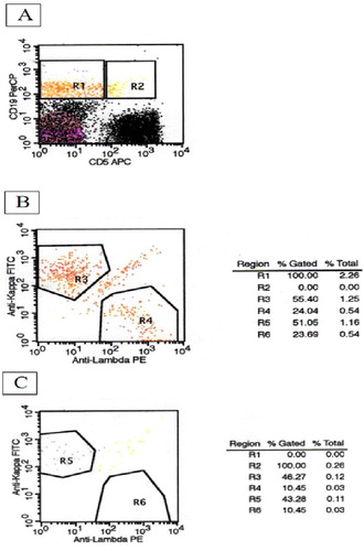 Figure 1. Two-step analysis method for the detection of monoclonal B-cell lymphocytosis, initial panel (B: κ/λ: 2.3; C: κ/λ: 4.14).