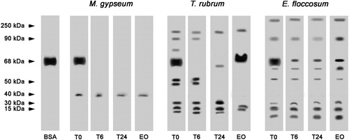 Figure 3. Effects of L. alba EO on the peptidase activity of T. rubrum, M. gypseum and E. floccosum culture supernatant extracts. BSA was used as a control. T0: control in which the reaction mixture (containing enzyme extract and keratin) was subjected to SDS-PAGE without incubation. T6: reaction mixture after six hours of incubation at 37 °C. T24: reaction mixture after overnight incubation at 37 °C. EO: reaction mixture containing L. alba EO after overnight incubation at 37 °C. The molecular weights of the proteins (in kDa) are provided at the left.