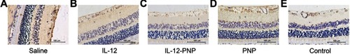 Figure 5 Analysis of VEGF-A expression in rat retina 7 d after intravitreal IL-12 or IL-12-PNP injections. Immunohistochemical assays were performed on tissue sections stained with rabbit anti-rat VEGF-A antibody and hematoxylin-eosin (H&E). Bar =100 μm.