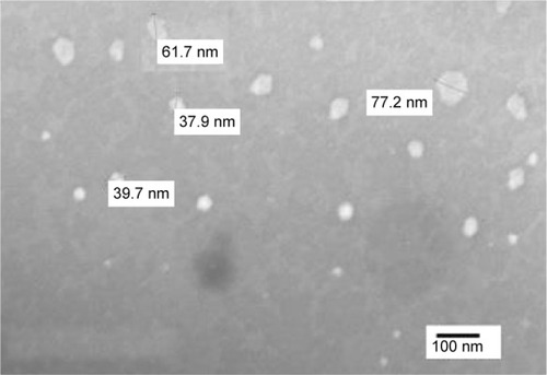 Figure 5 Transmission electron microscopy photograph of lecithin-based LCG (FC) with 10-fold dilution in capryol (magnification ×10,000).Abbreviations: FC, 38.46% lecithin, 46.16% capryol, and 15.38% water; LCG, liquid crystalline nanogel.
