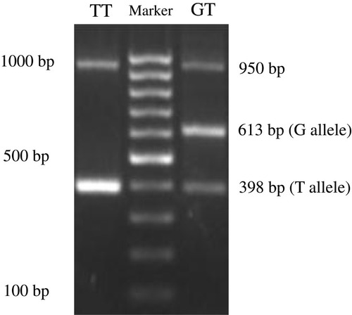 Figure 1 Visualization of the APM1 SNP rs2241766 using agarose gel electrophoresis.