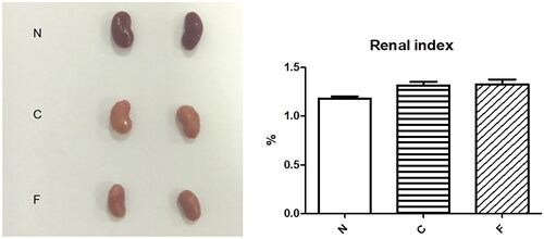 Figure 6. Anatomic appearance and renal index of mouse kidneys after 4 weeks of modeling.