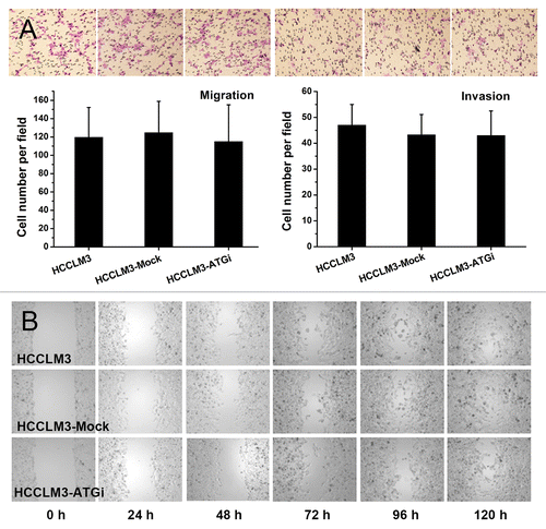 Figure 3. Effect of autophagy inhibition on migration and invasion of HCC cells. (A) Transwell migration and invasion assays showed no effect of autophagy inhibition on the migration and invasiveness of HCCLM3 cells. (B) The scratch assay showed results similar to the transwell migration assay.