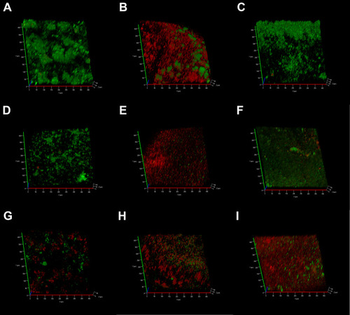 Figure 6 CLSM 3-dimensional reconstructions of E. faecalis biofilms (4-week old) after medication (green: live cells; red: dead cells).Notes: (A) Negative control group; (B) CH group; (C) MTA group; (D) MCSNs group; (E) Ag-MCSNs group; (F) Zn-MCSNs group; (G) Ag/Zn(1:9)-MCSNs group; (H) Ag/Zn(1:1)-MCSNs group; (I) Ag/Zn(9:1)-MCSNs group.Abbreviations: CLSM, confocal laser scanning microscope; CH, calcium hydroxide; MTA, mineral trioxide aggregate; MCSNs, mesoporous calcium-silicate nanoparticles; Ag-MCSNs, nanosilver-incorporated MCSNs; Ag/Zn-MCSNs, nanosilver- and nanozinc-incorporated MCSNs; Zn-MCSNs, nanozinc-incorporated MCSNs.