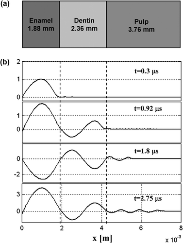 Figure 4 Stress profiles along the material at four specific times.