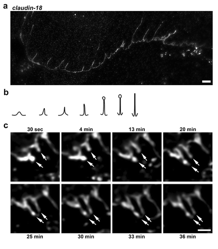 Figure 1. Morphological diversity of tight junction spikes. (a) AECs isolated from Sprague Dawley rats were cultured on collagen-coated coverslips for 6 d. The cells were then fixed, permeabilized, immunolabeled for claudin-18 and analyzed by stimulated emission depletion (STED) super-resolution microscopy, Bar: 2.5 µm. Images are representative of n = 14 fields collected from three coverslips from N = 2 biological replicates. (b) Diagram showing different morphological profiles of tight junction spikes observed by immunofluorescence. (c) Live-cell imaging of AECs expressing EYFP-cldn-18 showing two examples of tight junction spikes increasing in length over a 30-min period of observation (arrows). Bar: 2.5 µm