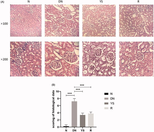 Figure 2. Effect of Yishen capsule on histological changes in the kidney of rats. (A) Representative histological images of sections from different groups at 100× and 200× magnification using an optical microscope. (B) Renal pathological scores. Values are presented as the mean ± SD. n = 10.