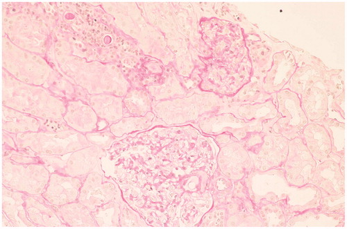 Figure 1. Light microscopy: PAS staining, normal glomeruli (200×).