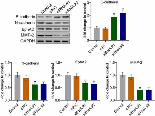 Figure 7. The EMT progression in tumor tissues was inhibited by the knockdown of AKAP4. The expression level of E-cadherin, N-cadherin, EphA2, and MMP-2 was determined by western blotting assay (**p < 0.01 vs. siNC). The controls were nude mice planted with H460 cells incubated with blank completed medium.
