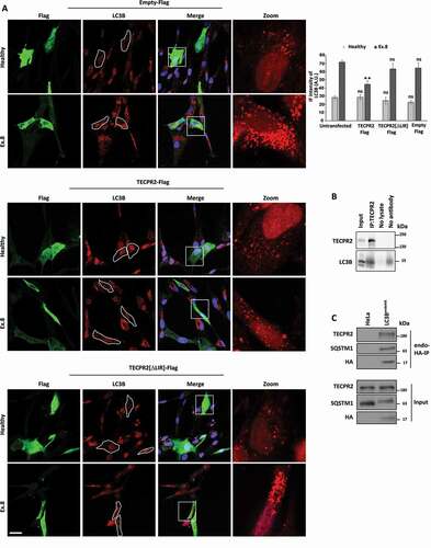 Figure 3. Replenishment of TECPR2 alleviates basal accumulation of autophagosomes in SPG49 patient fibroblasts in a LIR-dependent manner. (A) Primary fibroblasts of SPG49 Ex.8 mutant patient (and healthy control) were transfected for expression of TECPR2-Flag, TECPR2[ΔLIR]-Flag or empty Flag construct control using JetPrime transfection reagent for 48 h. Cells were then fixed with methanol, immunostained for LC3B and Flag and analyzed by confocal microscopy. Scale bar: 20 μm. The level of LC3B was calculated as relative intensity and presented with the SEM of three independent experiments, *p < 0.05, determined by one-way ANOVA with post-hoc Dunnett’s Multiple Comparison Test. (B) Endogenous TECPR2 was immunoprecipitated from HeLa cells with anti-TECPR2 antibody by protein G beads and co-co-precipitation of LC3B was probed by anti-LC3B antibody. (C) Lysates derived from parental HeLa and LC3BendoHA cells were immunoprecipitated with anti-HA followed by immunoblot analysis with indicated antibodies