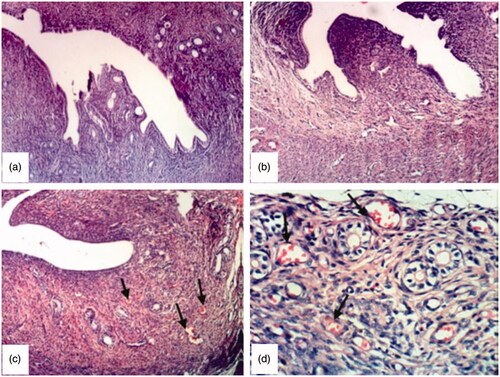 Figure 5. Photomicrograph of uterus from (a) group 1, control, untreated rat (×100), (b) group 2, rat treated with sildenafil solution (×100), (c) group 3, rat treated with chitosan coated liposomal dispersion, arrows show dilated and congested endometrial blood vessels, which appear as red spots (×100) (d) same as (c) at higher magnification (×400).