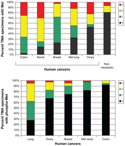 Figure 1 Expression (upper panel determined using a total anti-Met antibody) and activation (lower panel, determined using a phosphospecific Met antibody) of Met in non-small-cell lung cancer and other human tumors.Notes: The different colors and the corresponding numbers refer to negative (0, black), weak (1, green), moderate (2, yellow), or strong (3, red) staining.Copyright © 2008. John Wiley and Sons. Adapted from Ma PC, Tretiakova MS, MacKinnon AC, et al. Expression and mutational analysis of MET in human solid cancers. Genes Chromosomes Cancer. 2008;47(12):1025–1037.Citation19Abbreviation: TMA, tissue microarray.
