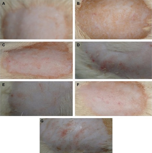 Figure 3 Skin photographs of the dorsal surface of rats.Notes: (A) Control group I showing no redness, no inflammation; (B) M. furfur diseased group, scales on the skin; (C) and (D) Groups III and IV treated with itracanozole and ketoconazole, respectively, showing skin with decreased scales as compared to Group II with pinkish color; (E) Group V (20 nm spherical Ag NPs) showing complete treatment of M. furfur as compared to Group II; (F) and (G) Groups VI and VII (50 nm spherical- and rod-shaped Ag NPs) also showed normalization of the skin but less as compared to group V.Abbreviations: M. furfur, Malassezia furfur; NPs, nanoparticles.