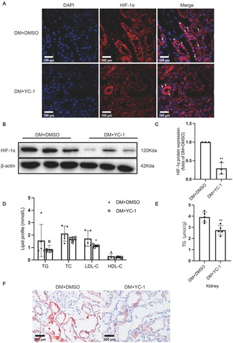 Figure 4. HIF-1α inhibition by YC-1 treatment decreased lipid accumulation in diabetic kidneys. (A) The protein expression of HIF-1α was detected by immunofluorescence staining (×400, marked by arrows) and (B-C) Western blotting (n = 3). Densitometry analysis of each protein band was performed using the software Image J, and normalized to β-actin. (D) TG, TC, LDL-C, and HDL-C levels in the serum were measured (n = 5-6). (E) Lipid accumulation in the kidneys of rats was quantified by the TG quantification assay, (n = 5). (F) Oil red O staining (×400) was conducted to observe neutral lipid accumulation in kidneys. Data are presented as mean ± SD. *p < 0.05, **p < 0.01 versus DM + DMSO.