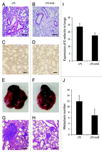 Figure 3. Anti-E-selectin treatment reduced lung metastasis. (A and B) Mice were treated with LPS alone or with LPS and anti-E-selectin antigen together (LPS-Anti-E), there lung structures were showed by H&E staining. (C, D, and I) E-selectin expression was detected and contrasted in LPS and LPS-Anti-E group. (E–H) H&E staining showed the metastasis foci in lungs of LPS and LPS-Anti-E group. (J) The metastasis number was also analyzed.