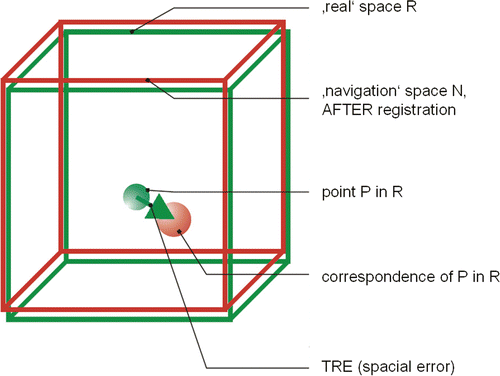 Figure 4. Target registration error (TRE), which is the distance between corresponding points other than the fiducial points after registration.