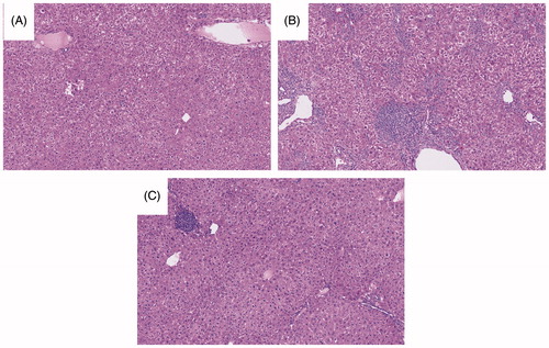 Figure 5. Stained liver sections. Samples shown are representative H&E-stained sections. (A) PD1−/−/anti-CCL2. (B) PD1−/−/anti-CTLA-4/AQ. (C) PD1−/−/anti-CTLA-4/AQ/anti-CCL2. Group identities are fully defined in Figure 4 legend. Anti-CCL2 treatment did not appear to cause significant abnormalities, while PD1−/− mice treated with anti-CTLA-4 and AQ demonstrated the characteristic numerous necro-inflammatory foci seen in previous experiments. PD1−/− mice treated with anti-CTLA-4, AQ, or anti-CCL2 still presented with a few necro-inflammatory foci in their liver; however, these were significantly fewer in prevalence than in livers of PD1−/− mice treated with anti-CTLA-4 and AQ in the absence of anti-CCL2.
