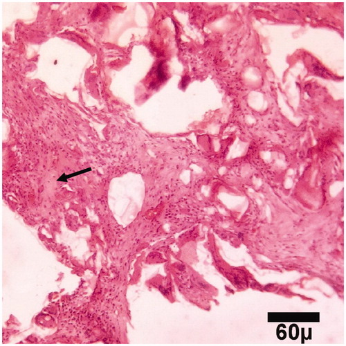 Figure 3. Microscopic section from the healing site of TCP-collagen-treated group on day 15 of healing shows the primary bone (arrow) formation (H&E, ×100).