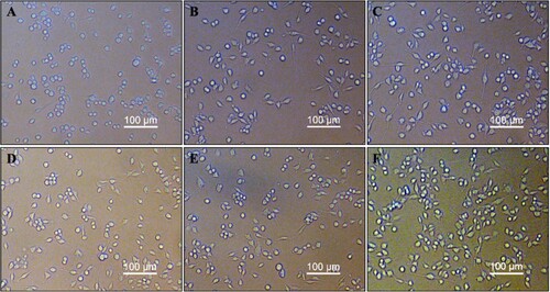 Figure 3. Effect of CP80-1 on RAW264.7 cell morphology. RAW264.7 cells were cultured with CP80-1 solution in different concentrations 0 μg/mL (A), 25 μg/mL (B), 50 μg/mL (C), 100 μg/mL (D), 200 μg/mL (E) or LPS (positive control, 1 μg/mL) (F) for 24 h.