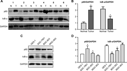 Figure 2 Expression levels of p65 and IκB-α in gastric cancer tissues and cells.