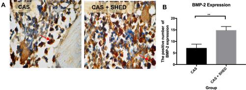 Figure 2 The periodontal tissue histological section of an afflicted subject. (A) AbMo and DAB were used to perform immunohistochemical analysis of BMP-2 expression. Positive cells appeared brown in color (red arrow) through a light microscope at 1000x magnification. (B) The number of positive expressions of BMP-2 is shown. The statistical significance of differences between groups was examined by means of an unpaired t-test (n = 7; **Information: significant at p < 0.01).