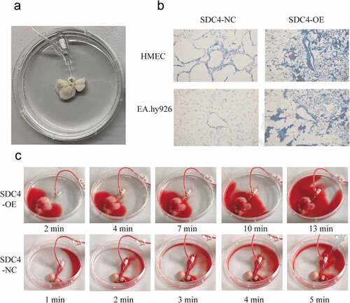 Figure 5. Re-endothelialization of liver scaffolds using syndecan-4 overexpressing EA.hy926