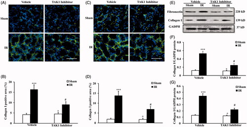 Figure 2. Inhibition of TAK1 decrease collagen I and fibronectin expression in kidney treated with IR. (A) Representative photomicrographs of collagen I immunofluorescence staining in kidneys of mice in vehicle group and TAK1 inhibitor group at 14 days after IR or sham treatment. (B) Quantitative analysis of collagen I positive area in kidneys of mice in vehicle group and TAK1 inhibitor group at 14 days after IR or sham treatment. ***p < .001 versus sham vehicle; +p < .05 versus TAK1 inhibitor IR; #p < .05 versus vehicle IR. n = 6 in each group. (C) Representative photomicrographs of fibronectin immunofluorescence staining in kidneys of mice in vehicle group and TAK1 inhibitor group at 14 days after IR or sham treatment. (D) Quantitative analysis of fibronectin positive area in kidneys of mice in Vehicle group and TAK1 inhibitor group at 14 days after IR or sham treatment. ***p < .001 versus sham vehicle; +p < .05 versus TAK1 inhibitor IR; #p < .05 versus Vehicle IR. n = 6 in each group. (E) Representative western blots showed protein levels of collagen I and fibronectin in kidneys of mice in vehicle group and TAK1 inhibitor group at 14 days after IR or sham treatment. (F) Quantitative analysis of collagen I protein expression of kidneys in vehicle group and TAK1 inhibitor group mice at 14 days after IR or sham treatment. ***p < .001 versus sham vehicle; +p < .05 versus TAK1 inhibitor IR; #p < .05 versus vehicle IR. n = 6 in each group. (G) Quantitative analysis of fibronectin protein expression of kidneys in vehicle group and TAK1 inhibitor group mice at 14 days after IR or sham treatment. ***p < .001 versus sham vehicle; +p < 0.05 versus TAK1 inhibitor IR; #p < .05 versus vehicle IR. n = 6 in each group.