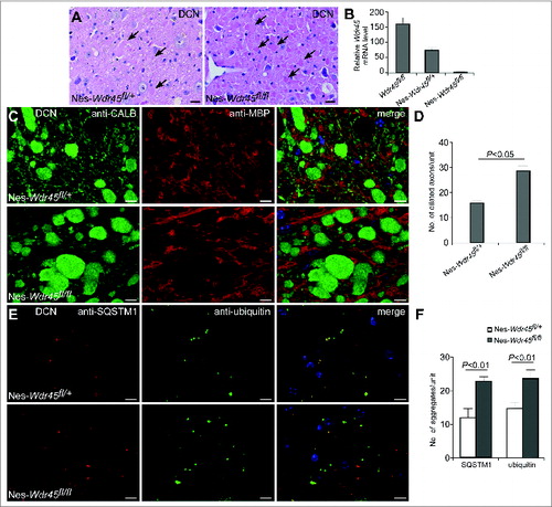 Figure 4. Axon swelling and autophagy defects in Nes-Wdr45fl/fl and Nes-Wdr45fl/+ female mice. (A) H&E staining of cerebellar sections shows accumulation of eosinophilic spheroids (arrows) in both Nes-Wdr45fl/+ and Nes-Wdr45fl/fl female mice at 13 mo. Bar: 20 µm. (B) The Wdr45 mRNA level in the brain of WT, Nes-Wdr45fl/+ mice and Nes-Wdr45fl/fl mice. Results are representative of at least 3 experiments. (C and D) Costaining of CALB (green) and MBP (red) in DCN of Nes-Wdr45fl/+ and Nes-Wdr45fl/fl female mice at 13 mo. Quantification data are shown as mean±SEM of 3 mice (1 unit = 104 μm2) (D). (E and F) SQSTM1 (red) and Ubiquitin (green) costaining in DCN of Nes-Wdr45fl/+ and Nes-Wdr45fl/fl female mice at 13 mo. Quantification data are shown as mean ± SEM of 3 mice (1 unit = 104 μm2) (F). Bar: 10 µm (C and E).