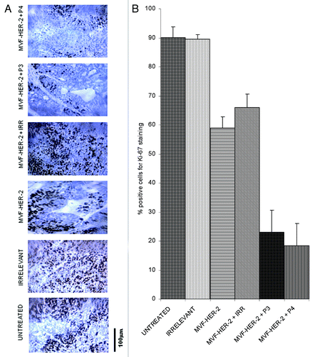 Figure 7. Combination treatment decreases the number of actively dividing cells in a transplantable mouse model of breast cancer. Quantification of the number of actively dividing cells in tumor sections using Ki-67 staining. (A) Tissue sections show the amount of positive cells. The stain is specific for cells that are actively dividing. (B) Quantification of the staining using Image J software. Data represent mean values from four different fields and error bars represent SD of the mean.