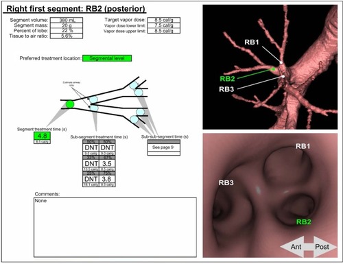 Figure 1 InterVapor Personalized Procedure Program (IP3).