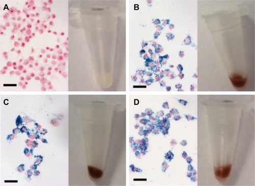 Figure 2 Cell phantoms of macrophages labeled with NPs as measured with OCT and Prussian blue iron staining.Notes: White cell pellets correspond to non-labeled RAW 264.7 macrophages (A) in comparison to brown cells pellets after NP uptake on incubation of macrophages with (B) 1 mM Fe VSOP, (C) 2 mM Fe VSOP and (D) 8.9 mM Fe ferumoxytol. All cells show intracellular NP uptake (B–D) and preserved cell morphology and viability in comparison with non-labeled cells (A). All scale bars correspond to 50 µm.Abbreviations: NP, nanoparticle; OCT, optical coherence tomography; VSOP, very small iron oxide particles.