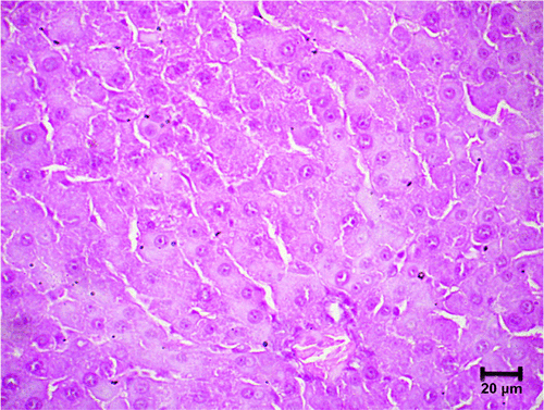 Figure S3 Image showing morphological signs of liver regeneration, without microparticle waste in the ceftiofur–PHBV group.
