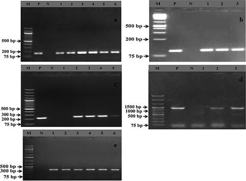 Figure 5. Gel electrophoresis images (5a–5e) depict the amplified PCR products of different virulence genes, namely sea (102 bp), seb (164 bp), pvl (255 bp), eta (1155 bp), and tst (326 bp), respectively. In all gel electrophoresis processes, a 1 kb plus DNA marker was used to confirm the amplification of a specific virulence gene. Additionally, lanes M, N, and P represent the DNA markers, negative control, and positive control, respectively.
