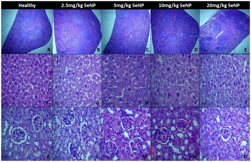 Figure 7 Histopathological cross-sections of SeNP administered (doses 2.5 mg/kg, 5 mg/kg, 10 mg/kg and 20 mg/kg) mice spleens compared to healthy control spleen at magnification 4X depicted clearly defined red and white pulp in all mice groups (A, B, C, D, E). Histological longitudinal sections of SeNP administered (doses 2.5 mg/kg, 5 mg/kg, 10 mg/kg and 20 mg/kg) mice livers compared to healthy control liver depicted intact hepatocellular morphology at 40X magnification in all mice groups (F, G, H, I, J). Histological bisections of SeNP-administered (doses 5 mg/kg, 10 mg/kg and 20 mg/kg) mice kidneys compared to healthy control kidney at 40X magnification depicted intact glomerular structures (K, M, N, O). Mice administered 2.5 mg/kg dose of selenium nanoparticles showed somewhat distorted glomeruli (L).Abbreviation: SeNP, selenium nanoparticles.