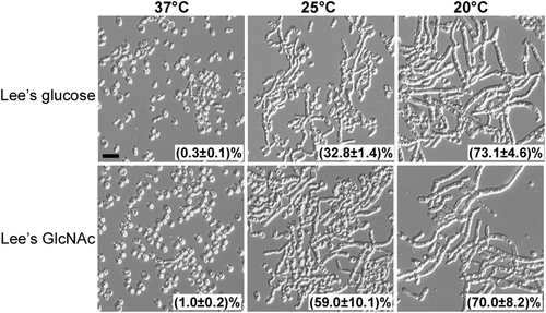 Fig. 3 Effect of culture temperature on the persistence of the filamentous phenotype.Filamentous cells were plated on Lee’s glucose and Lee’s GlcNAc media for 7 days of growth at 37, 25, or 20 °C. Cellular morphology of representative colonies was examined. Percentage of filamentous cells are indicated. Approximately 1500–2000 cells were examined for each culture. Scale bar represents 10 μm