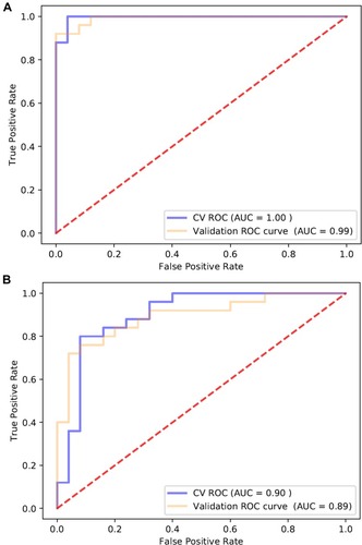 Figure 6 ROC curve analysis of AMACR, LDHB, and RAP1B combination using (A) proteomics data and (B) ELISA data to discriminate HIV-TB from HIV-nonTB individuals.