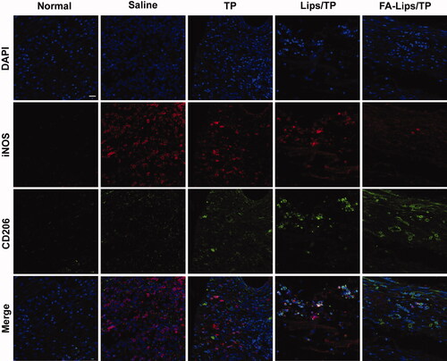 Figure 7. Immunofluorescence staining of M1 macrophage (iNOS, red) and M2 macrophage (CD206, green) markers in RA joints after treatment. Scale bar represents 20 μm.