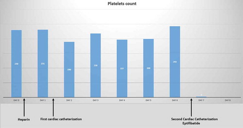 Figure 1. Platelet count trend over time (K/uL)